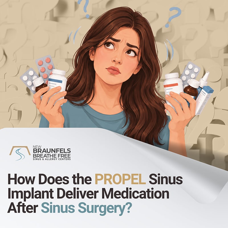 How Does the PROPEL Sinus Implant Work? How Does the PROPEL Sinus Implant Work?